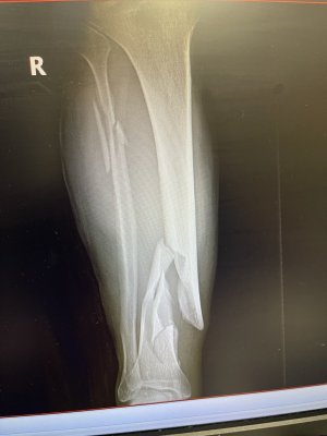 X-Ray pre-surgery.jpg